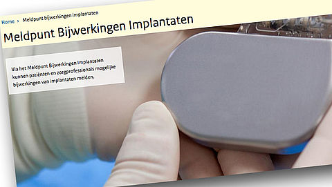 Bijwerkingen implantaten melden bij het RIVM