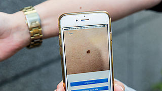 'Apps om huidplekjes te scannen geven niet altijd correcte diagnose'