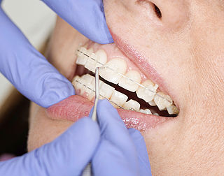 Zorgwaakhond pakt orthodontisten aan