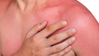Is zonnebrand waterproof? En: krijg je vitamine D-tekort door smeren?