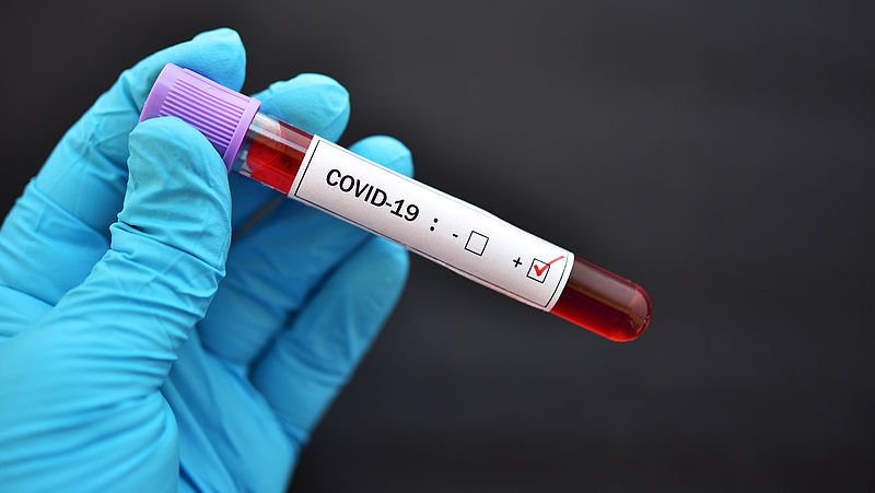 Gratis coronatest beschikbaar voor iedereen met milde klachten