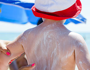 'Zonnebrandcrème voorkomt huidkanker niet'