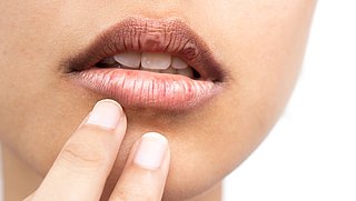 Last van droge lippen? Dit moet je weten