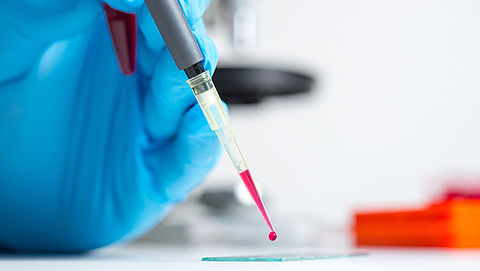 Onderzoekers kunnen met nieuwe bloedtest genetische ziekten opsporen