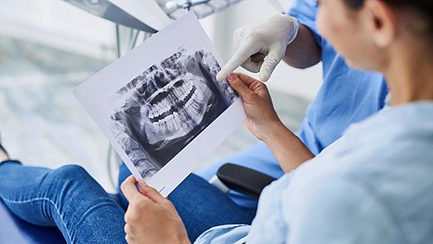 Mag je een röntgenfoto bij de tandarts weigeren?