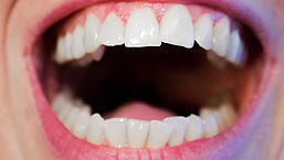 Zo kom je van die slechte adem af: 10 tips van de parodontoloog