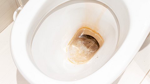 Bruine aanslag in je toilet? Zo krijg je het weg