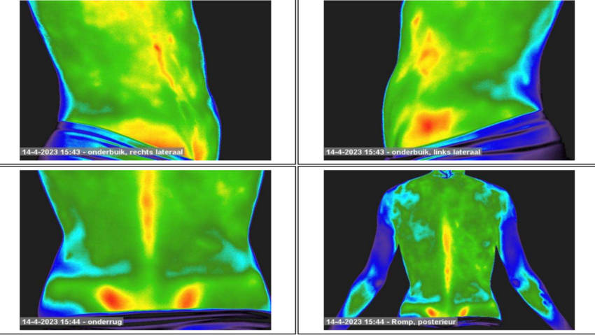 Thermografie