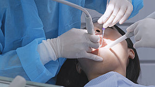Wanneer is een aanvullende tandartsverzekering voordelig?