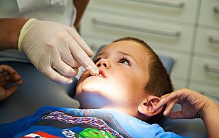 Minder kinderen naar de tandarts: 'Kan leiden tot complicaties'
