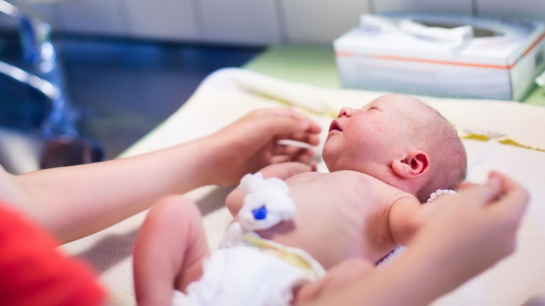 Te vroeg geboren baby langer aan navelstreng