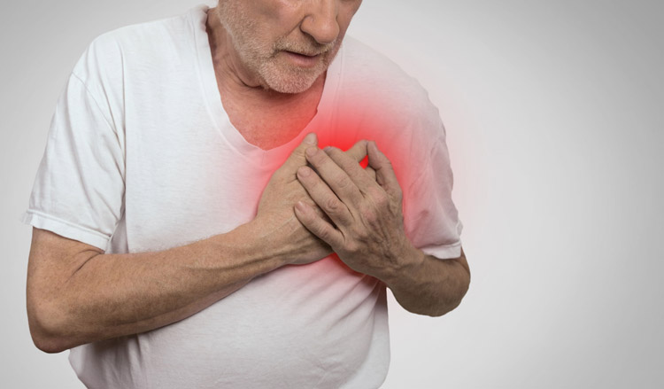 Risico hartinfarct door slagaderverkalking wordt onderschat