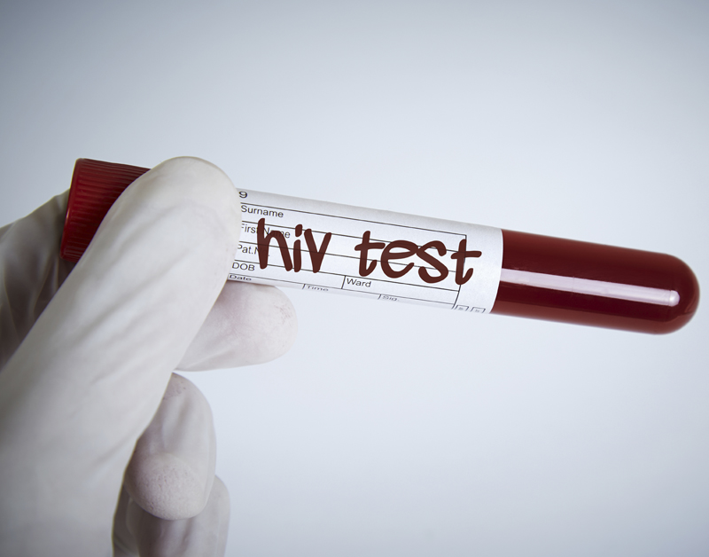 Minder hiv in Nederland dan gedacht