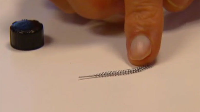 Meer vrouwen met klachten door spiraaltje Essure