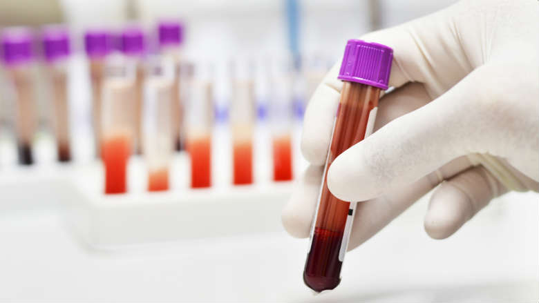 'Bloedtest voor alzheimer binnen jaar op de markt'