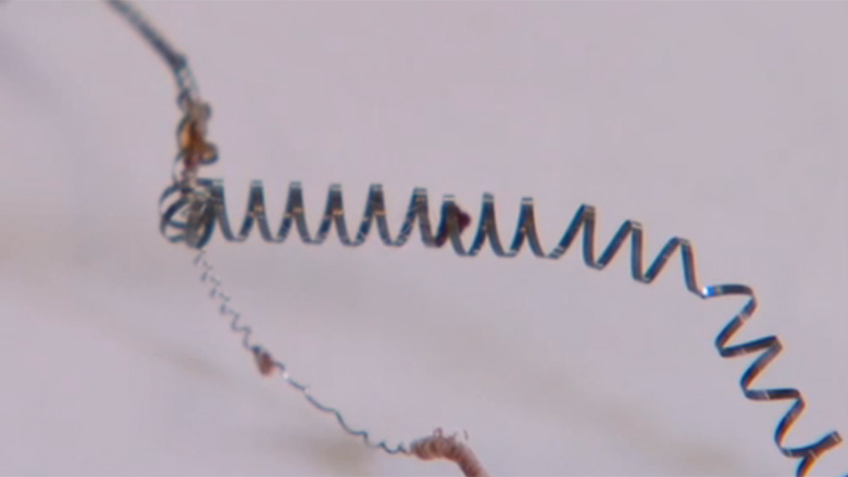 Vrouwen naar rechter om Essure implantaat