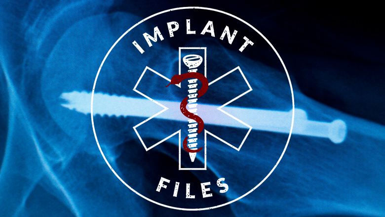 Implant Files: honderden WOB-verzoeken en weggelakte informatie
