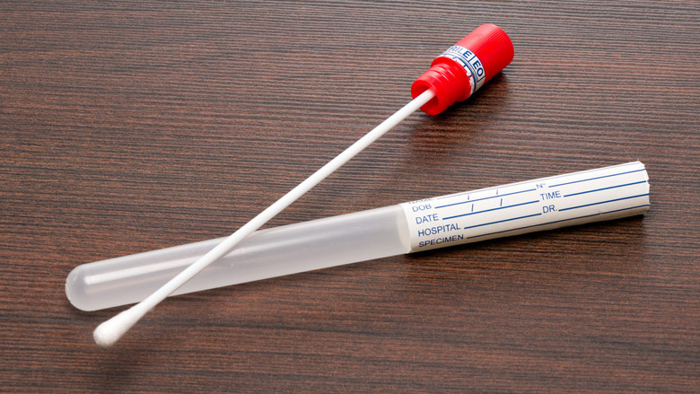 Heb jij een slechte ervaring gehad met thuis testen op SOA's?