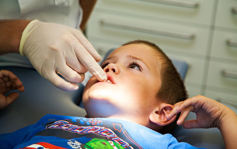 Minder kinderen naar de tandarts: 'Kan leiden tot complicaties'