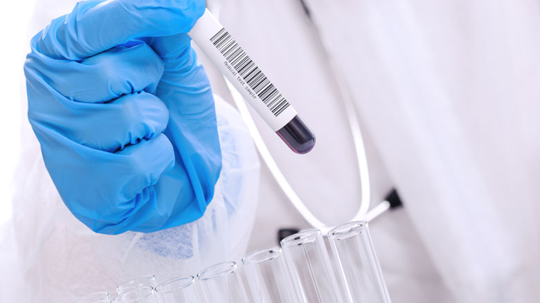 Trombose en het coronavirus: wat moet je weten over het onderzoek?